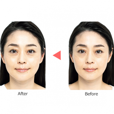 BEAUTY ARMOR]整体枕 RESET(リセット) | 光文社公式美容サイト kokode